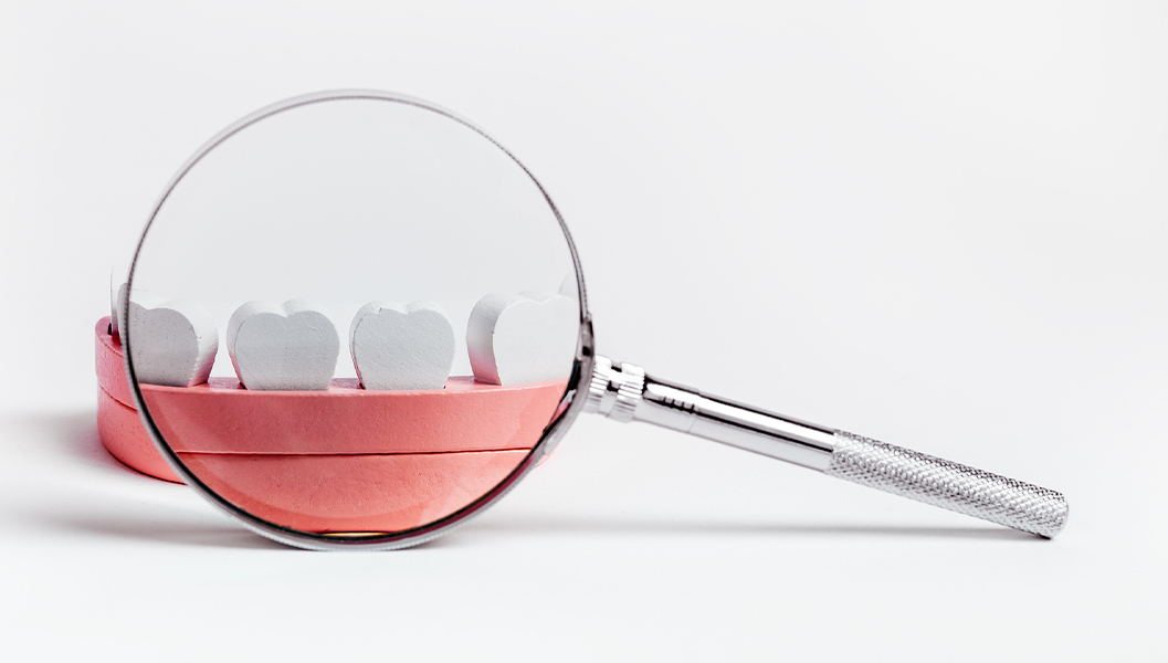 天神・福岡市中央区のなるべく神経を抜かない治療