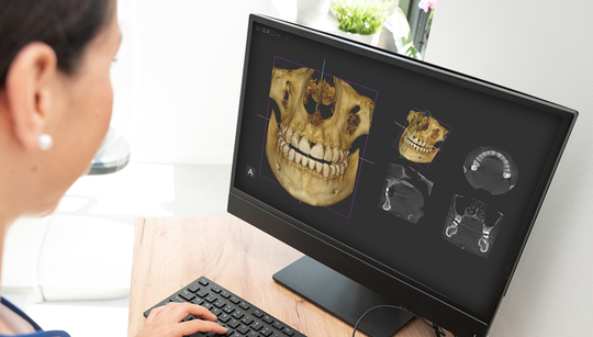 天神・福岡市中央区の歯科用CT